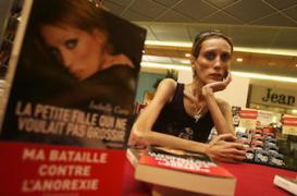Un député veut sanctionner l'exploitation de l'anorexie 