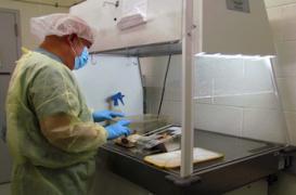 VIH : des crèmes pour les pieds ont réussi à bloquer le virus