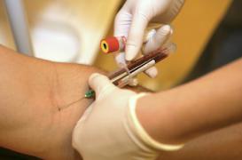 Cancer : la biopsie bientôt remplacée par une simple prise de sang