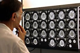 Une Semaine du cerveau pour percer ses mystères