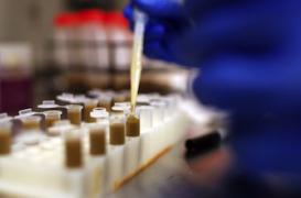 Marseille : le Clostridium difficile a un fort potentiel pandémique