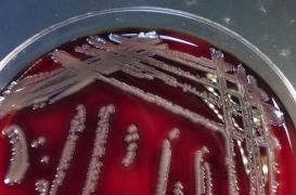 USA : Une bactérie tueuse inquiète les Etats-Unis