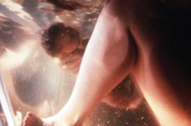 L'accouchement dans l'eau ne serait pas sans risque