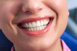 Blanchiment des dents : l'Ansm retire des produits dangereux 