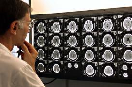 L'exposition médicale aux rayons ionisants a augmenté de 50 %