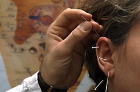 Maigrir avec l'acupuncture auriculaire 