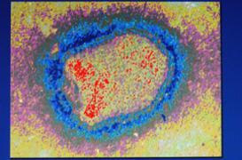 La rage tue un homme en Ile-de-France