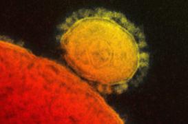 Coronavirus MERS : l’Homme dispose d’anticorps naturels   