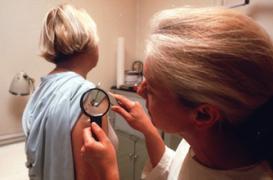 Feu vert pour un médicament dans le cancer de la peau 
