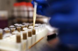 Clostridium difficile : pourquoi la bactérie inquiète les médecins de Marseille