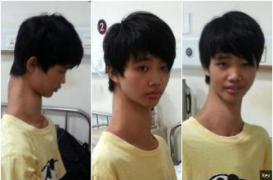 Opération : un jeune chinois possède 3 vertèbres de trop