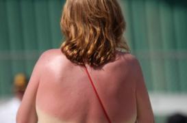 L'excès d'alcool augmente le risque de cancer de la peau