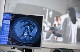 Scanner : réduire l'exposition des enfants aux radiations 