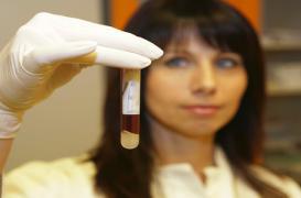 Trisomie 21 : les tests sanguins plus performants que l'amniocentèse 