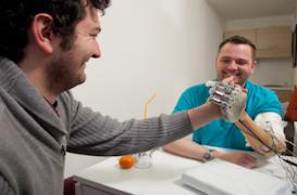 Main bionique : des sensations 9 ans après l'amputation