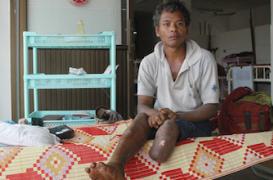 Journée des lépreux : des quêtes pour faire disparaître la maladie