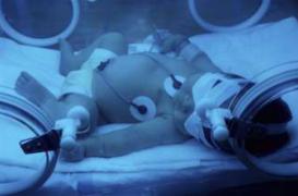 Bébé prématuré : 