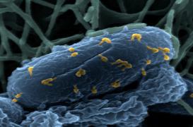 Des virus contre la mucoviscidose