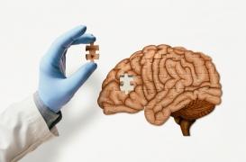 Un simple test urinaire pourrait détecter les tumeurs cérébrales