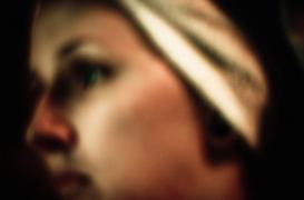 Acné : les antibiotiques trop souvent utilisés à tort