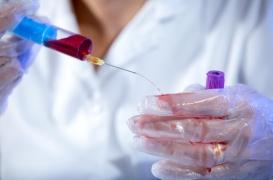 Creutzfeld-Jakob : l'INRAE reconnaît un décès dû à un accident de laboratoire