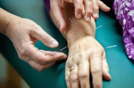 Fibromyalgie : l’acupuncture atténue la douleur