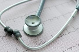 Frédéric, 71 ans, opéré d'une fibrillation atriale :