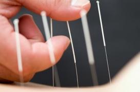 Inde : un homme aurait ingéré 75 aiguilles et épingles