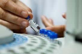 Un test pour le diagnostic précoce de la sclérose en plaques