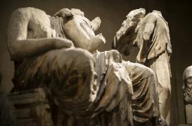 Douleurs fantômes : une interface cerveau-machine permet de les réduire