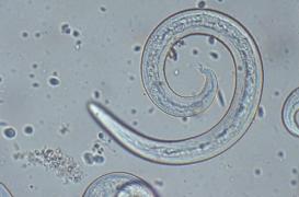 Un Australien décède 8 ans après avoir avalé une limace infectée à un parasite