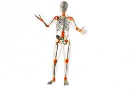 Polyarthrite rhumatoïde : la repérer 7 ans avant les premiers symptômes