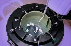 Autoconservation d'ovocytes : pourquoi le comité d'éthique s'y oppose