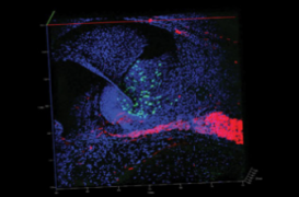 Un implant cochléaire amélioré permet de retrouver une ouïe fine