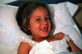 Alerte à la varicelle dans 12 régions