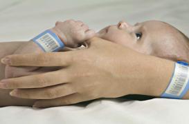 Dépistage de la surdité: 2 bébés sur 3 n'en bénéficient pas