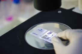 Traitements personnalisés : les promesses de la génétique