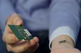 Un laboratoire d’analyses médicales sous la peau