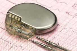 Pacemakers : limiter les risques de piratage