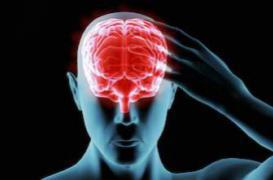 Migraine : un traitement  par radiologie efficace