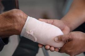 Santé cardiaque : les troubles microvasculaires augmentent le risque d’amputation