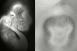 Italie : une femme enceinte de jumeaux qui ne sont pas les siens