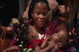 Sœurs siamoises séparées à Lyon : la petite Bissie désormais “hors de danger”