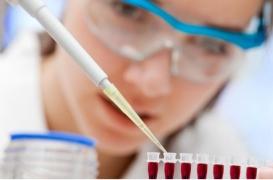 Cancer de la peau : des chercheurs mettent au point un test sanguin pour détecter le mélanome