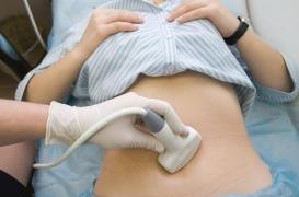 Trisomie 21 : l'erreur de diagnostic du CHU de Limoges condamnée