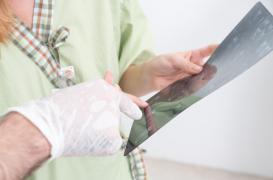 Cancer : bloquer la fabrication de vaisseaux limiterait les métastases