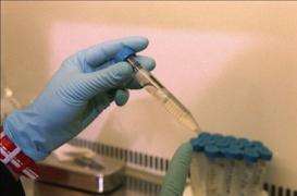 Trisomie 21 : le chromosome de trop pourrait être réduit au silence  