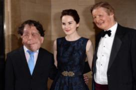 Neurofibromatose : une maladie rare s'affiche sur grand écran