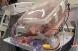 Des chercheurs australiens greffent des coeurs qui ont cessé de battre