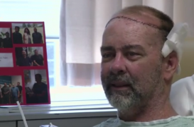 Une greffe partielle du crâne réalisée chez un Américain 